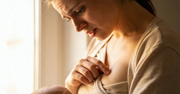 Tipos de Mastitis: Guía Visual con Imágenes